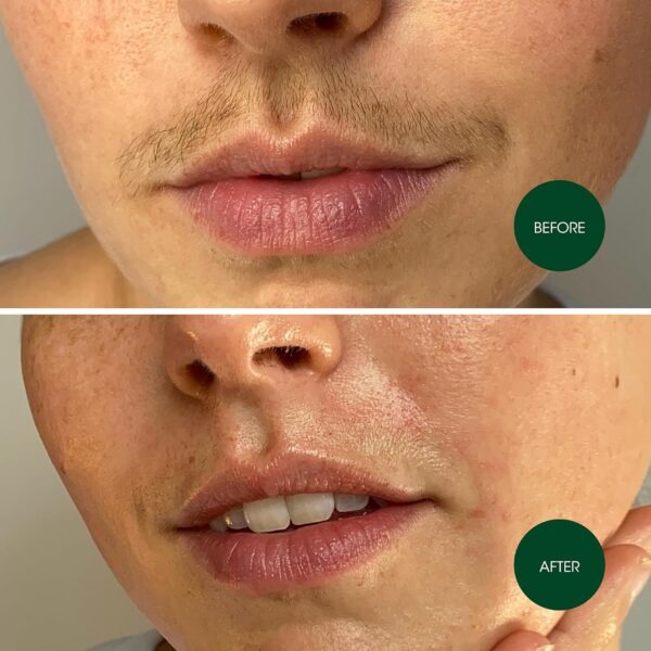 Nad’s Facial Wax Strips – Hypoallergenic At-Home Hair Removal Kit for Women with Calming Wipes & Protection Powder